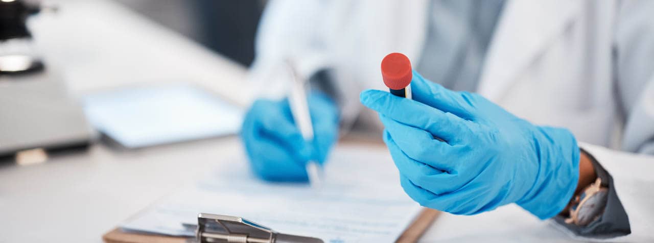 Five Lab Markers That Reveal Hidden Inflammation